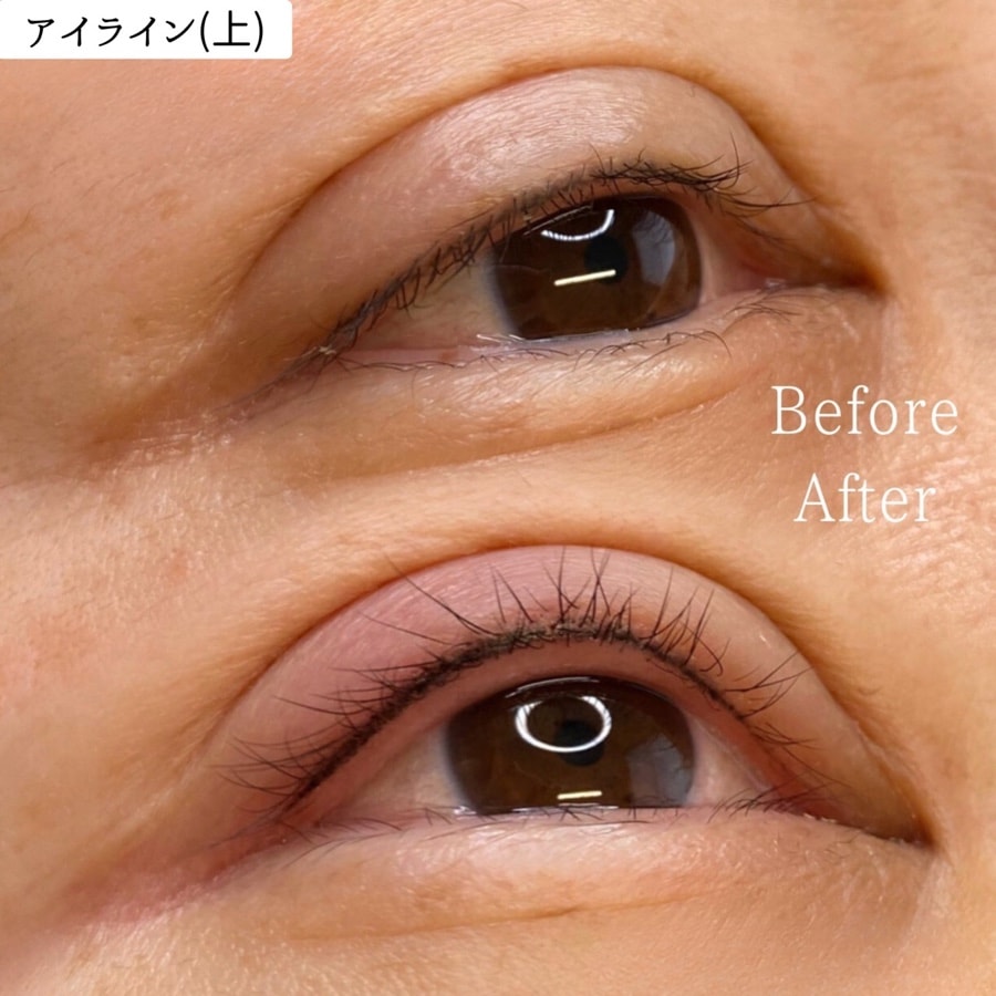 アイライン
