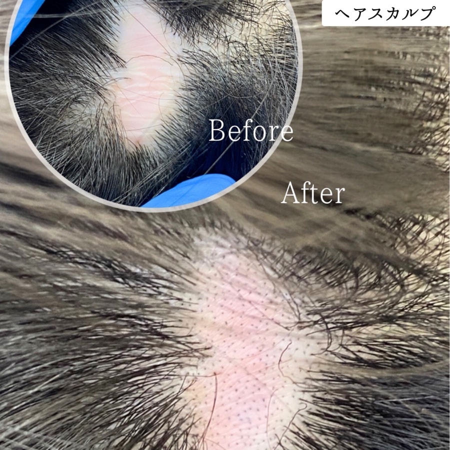 ヘアスカルプ