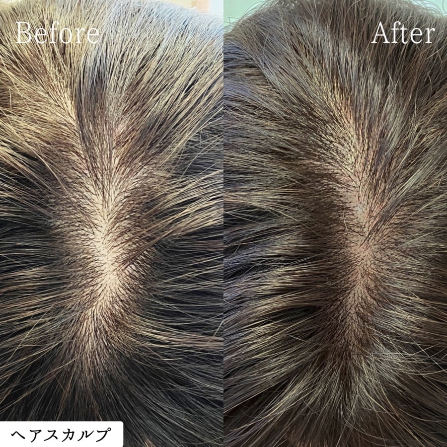 ヘアスカルプ