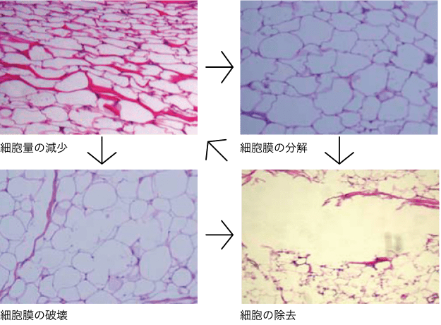 脂肪細胞膜の変化